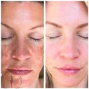 Serum 24K - Clareador Removedor de Manchas